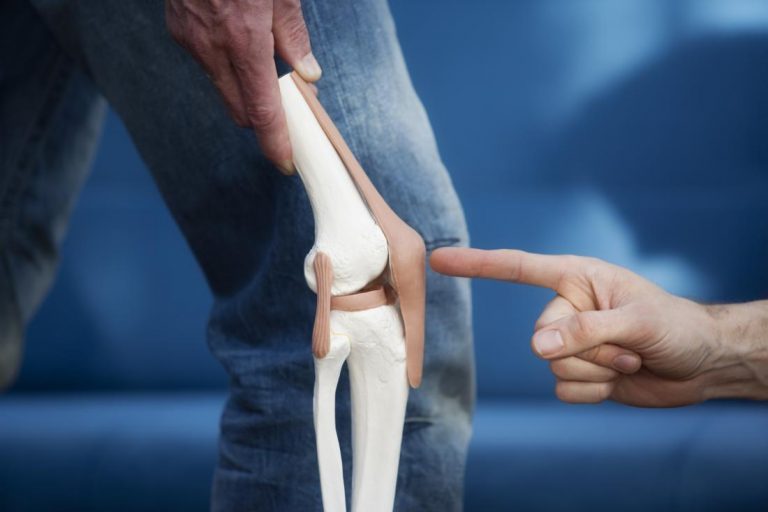 patella-tendonitis-demonstrated-by-model-of-knee-cap-with-patella-tendon-being-pointed-to-in-front-of-person-s-leg-768x512